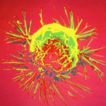A breast cancer cell (NHGRI)